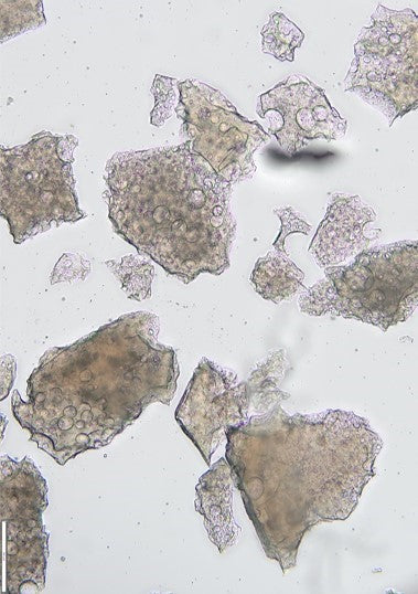 Spryng® with OsteoCushion® Technology