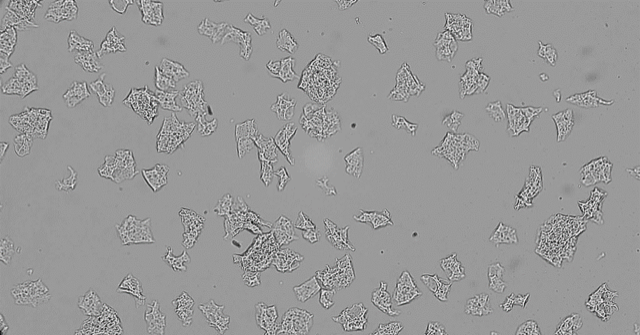 Spryng® with OsteoCushion® Technology